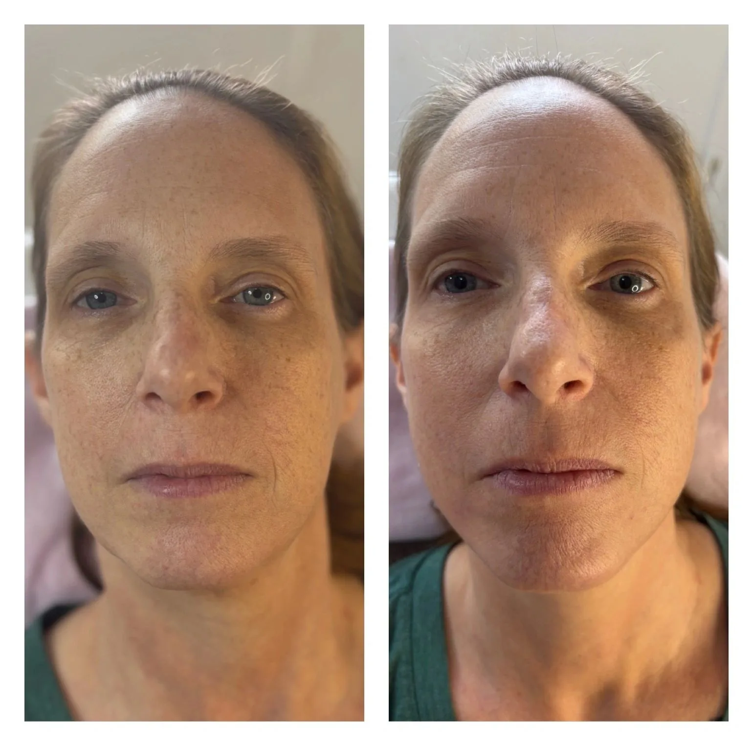 Facial Aesthetics in Accra — Body Language by Mandz