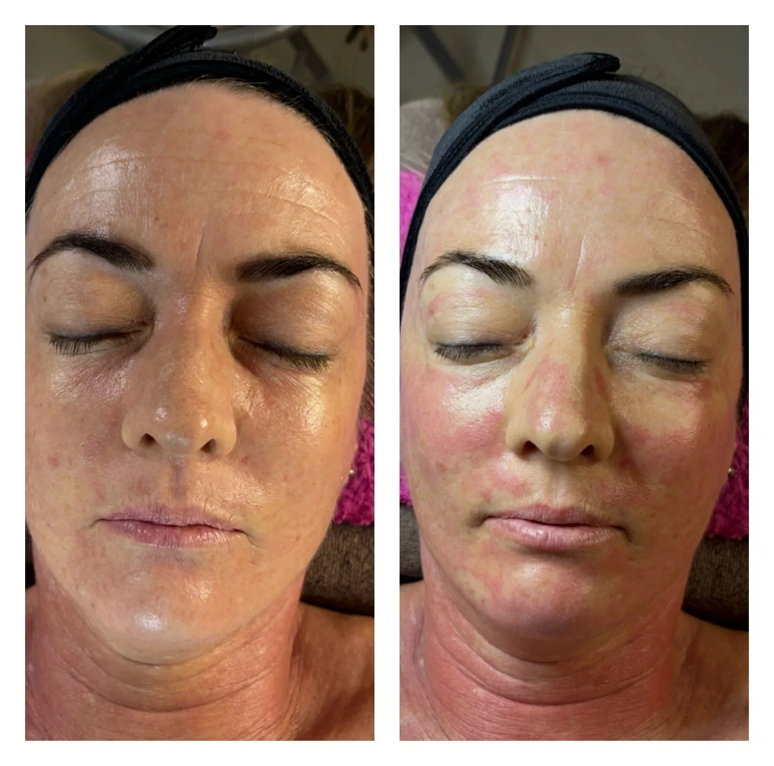 Skin Rejuvenation in Accra — Body Language by Mandz