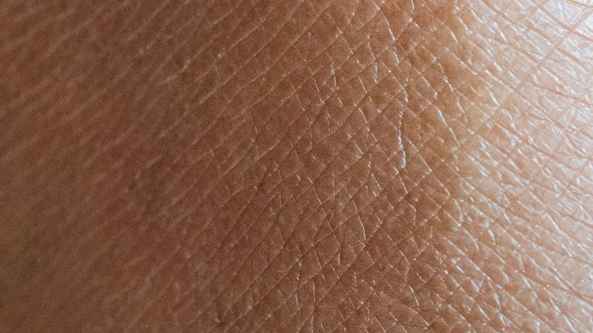 Dark Spots on Melanin-Rich Skin: What Actually Fades Them